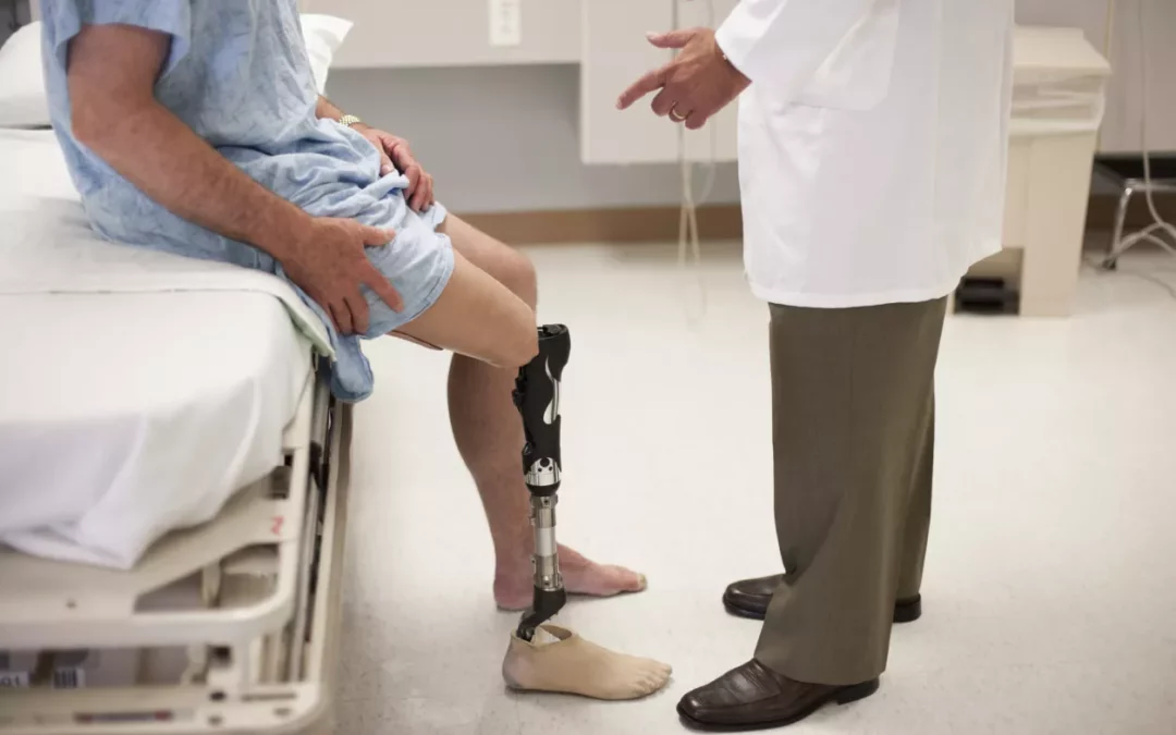 How Can a Stroke Lead to an Amputated Leg?