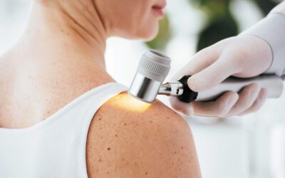 When Squamous Cell Carcinoma is Missed: Why Early Action and Patient Transparency Matter